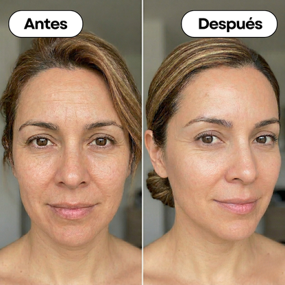 Cambio visual de antes y después usando Night Repair Serum: reducción de líneas de expresión y mejora de firmeza en piel madura.