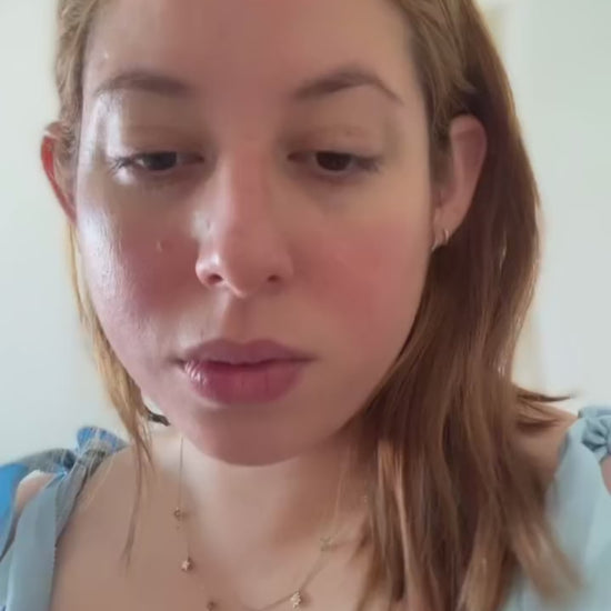 Testimonio clientecon rosacea como mejoró la textura, tono y brillo de su piel