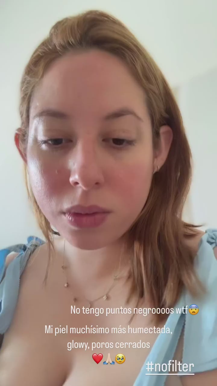 Testimonio clientecon rosacea como mejoró la textura, tono y brillo de su piel